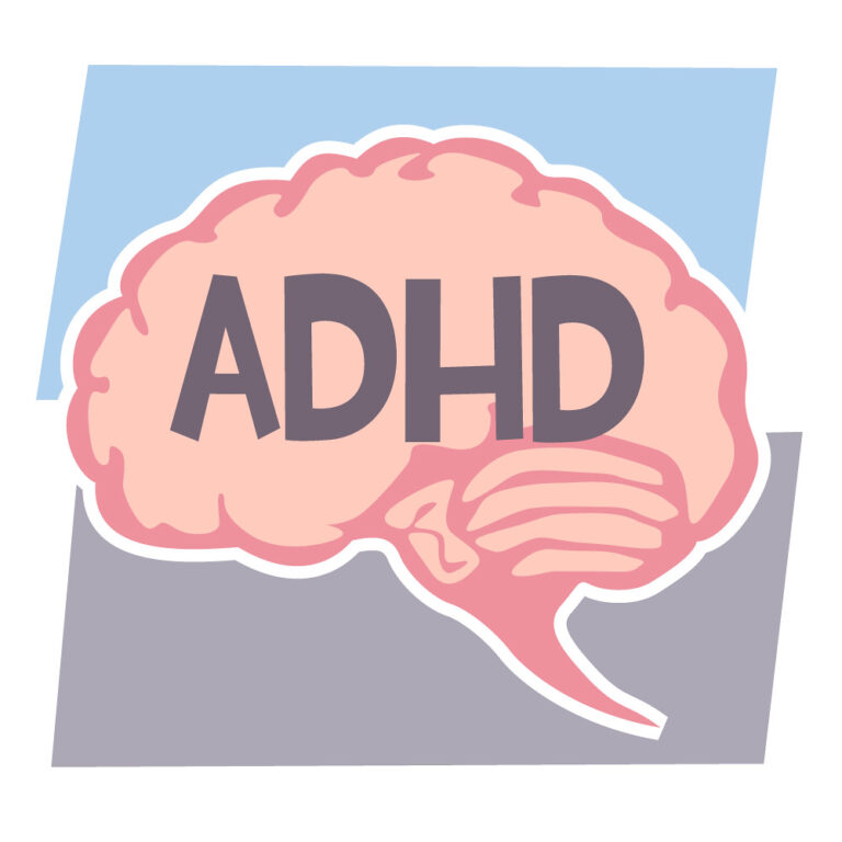 Illustratie van een menselijk brein met de letters "ADHD" prominent weergegeven. De achtergrond bestaat uit overlappende blauwe en grijze rechthoeken.