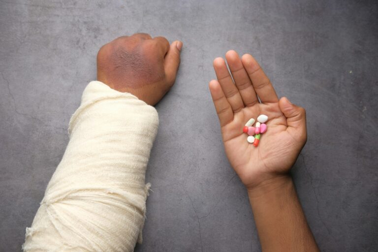 Een persoon met een gebandeerde arm legt deze op een grijs oppervlak. De andere hand is open en houdt een mix van pillen en tabletten vast in verschillende vormen en kleuren.